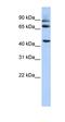 Dipeptidyl Peptidase Like 10 antibody, orb330387, Biorbyt, Western Blot image 