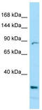 Prickle-like protein 2 antibody, TA337710, Origene, Western Blot image 