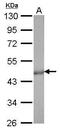 Citrate synthetase antibody, MA5-17264, Invitrogen Antibodies, Western Blot image 