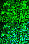 Eukaryotic translation initiation factor 5 antibody, 22-331, ProSci, Immunofluorescence image 