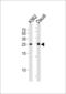 MOB Kinase Activator 1B antibody, MBS9202096, MyBioSource, Western Blot image 