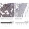 Alpha-1,3-Mannosyl-Glycoprotein 4-Beta-N-Acetylglucosaminyltransferase A antibody, NBP1-81809, Novus Biologicals, Immunohistochemistry paraffin image 