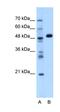 Glutamic--Pyruvic Transaminase antibody, orb330441, Biorbyt, Western Blot image 