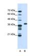Poly(RC) Binding Protein 1 antibody, orb330138, Biorbyt, Western Blot image 