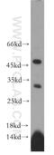 RAD52 motif-containing protein 1 antibody, 20156-1-AP, Proteintech Group, Western Blot image 