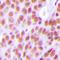 Nuclear Autoantigenic Sperm Protein antibody, orb378192, Biorbyt, Immunohistochemistry paraffin image 