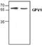 Glycoprotein VI Platelet antibody, GTX59750, GeneTex, Western Blot image 