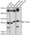 Thioesterase superfamily member 4 antibody, A15940, ABclonal Technology, Western Blot image 