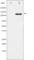 Platelet Derived Growth Factor Receptor Beta antibody, abx011958, Abbexa, Western Blot image 