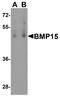 Bone Morphogenetic Protein 15 antibody, A01842-2, Boster Biological Technology, Western Blot image 