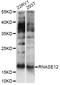 Ribonuclease A Family Member 12 (Inactive) antibody, LS-C749609, Lifespan Biosciences, Western Blot image 