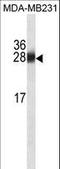 Glutathione S-Transferase Mu 1 antibody, LS-C159794, Lifespan Biosciences, Western Blot image 