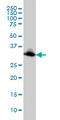 Emerin antibody, LS-C133167, Lifespan Biosciences, Western Blot image 