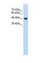 Solute Carrier Family 38 Member 1 antibody, NBP1-59649, Novus Biologicals, Western Blot image 