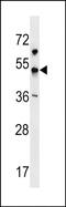 Potassium Voltage-Gated Channel Subfamily J Member 18 antibody, PA5-72097, Invitrogen Antibodies, Western Blot image 