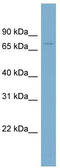 Gigaxonin antibody, TA344325, Origene, Western Blot image 