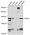 T Cell Lymphoma Invasion And Metastasis 1 antibody, 13-533, ProSci, Western Blot image 