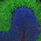 Spectrin Alpha, Non-Erythrocytic 1 antibody, NBP1-92689, Novus Biologicals, Immunofluorescence image 