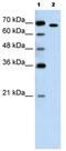 RAR Related Orphan Receptor A antibody, ab60134, Abcam, Western Blot image 