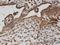 Adaptor Related Protein Complex 2 Subunit Beta 1 antibody, H00000163-M01, Novus Biologicals, Immunohistochemistry paraffin image 