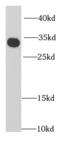 Replication protein A 32 kDa subunit antibody, FNab07392, FineTest, Western Blot image 