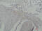 Galectin 3 antibody, GTX34033, GeneTex, Immunohistochemistry paraffin image 