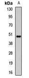 8-Oxoguanine DNA Glycosylase antibody, orb411993, Biorbyt, Western Blot image 