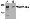 Signal Induced Proliferation Associated 1 Like 2 antibody, PA5-20848, Invitrogen Antibodies, Western Blot image 