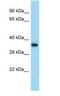 Transmembrane Protein 164 antibody, NBP1-98383, Novus Biologicals, Western Blot image 