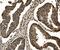 Proteasome Subunit Beta 7 antibody, A08095-1, Boster Biological Technology, Immunohistochemistry paraffin image 