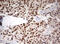 Tripartite Motif Containing 24 antibody, M03258, Boster Biological Technology, Immunohistochemistry paraffin image 