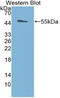 Type III iodothyronine deiodinase antibody, LS-C314988, Lifespan Biosciences, Western Blot image 