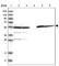 Aldehyde Dehydrogenase 1 Family Member B1 antibody, HPA021037, Atlas Antibodies, Western Blot image 