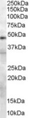 Plasminogen Activator, Urokinase antibody, 45-114, ProSci, Western Blot image 