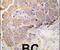 Heat Shock Protein Family B (Small) Member 1 antibody, PA5-14022, Invitrogen Antibodies, Immunohistochemistry paraffin image 