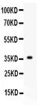 FGF1 antibody, PB9241, Boster Biological Technology, Western Blot image 