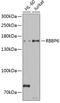 RB Binding Protein 6, Ubiquitin Ligase antibody, 22-593, ProSci, Western Blot image 