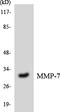 Matrix Metallopeptidase 7 antibody, LS-B12494, Lifespan Biosciences, Western Blot image 