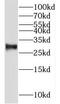 Nipsnap Homolog 3B antibody, FNab05739, FineTest, Western Blot image 