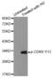 Cyclin Dependent Kinase 6 antibody, STJ22064, St John