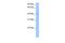 Poly(A) Binding Protein Interacting Protein 1 antibody, GTX47345, GeneTex, Western Blot image 