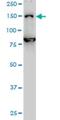 DEAH-Box Helicase 8 antibody, H00001659-M01, Novus Biologicals, Western Blot image 