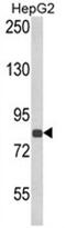 Endothelin Converting Enzyme 1 antibody, AP17997PU-N, Origene, Western Blot image 