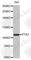 Protein Tyrosine Kinase 2 antibody, A0024, ABclonal Technology, Western Blot image 