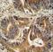 VPS52 Subunit Of GARP Complex antibody, LS-C160542, Lifespan Biosciences, Immunohistochemistry paraffin image 