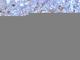 Ig kappa-b4 chain C region antibody, NBP2-45064, Novus Biologicals, Immunohistochemistry frozen image 
