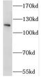 Serine/Threonine Kinase 31 antibody, FNab08330, FineTest, Western Blot image 