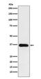 Hydroxysteroid 11-Beta Dehydrogenase 1 antibody, M01565-1, Boster Biological Technology, Western Blot image 