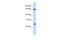 Tripartite Motif Containing 8 antibody, 25-540, ProSci, Western Blot image 