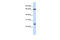 Probable E3 ubiquitin-protein ligase TRIM8 antibody, 25-540, ProSci, Western Blot image 